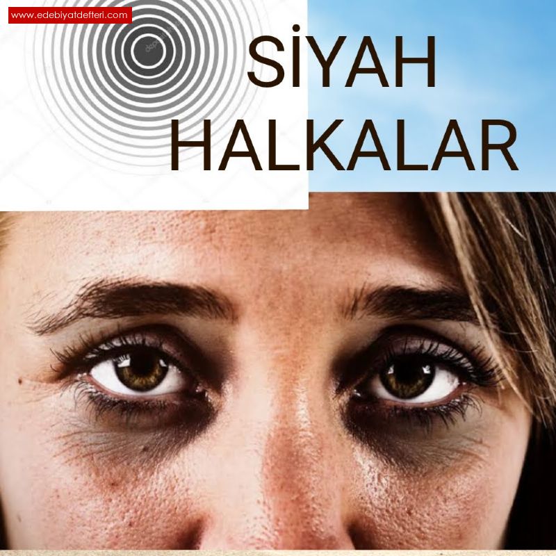 Siyah Halkalar