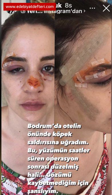 YETER ARTIK